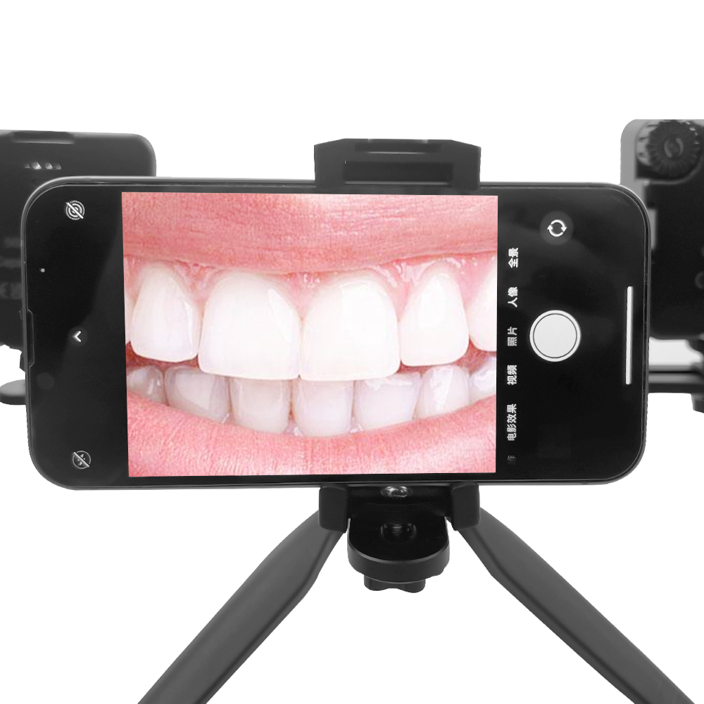 Luz LED intraoral para fotogra - Lighting Visual reseña y precio